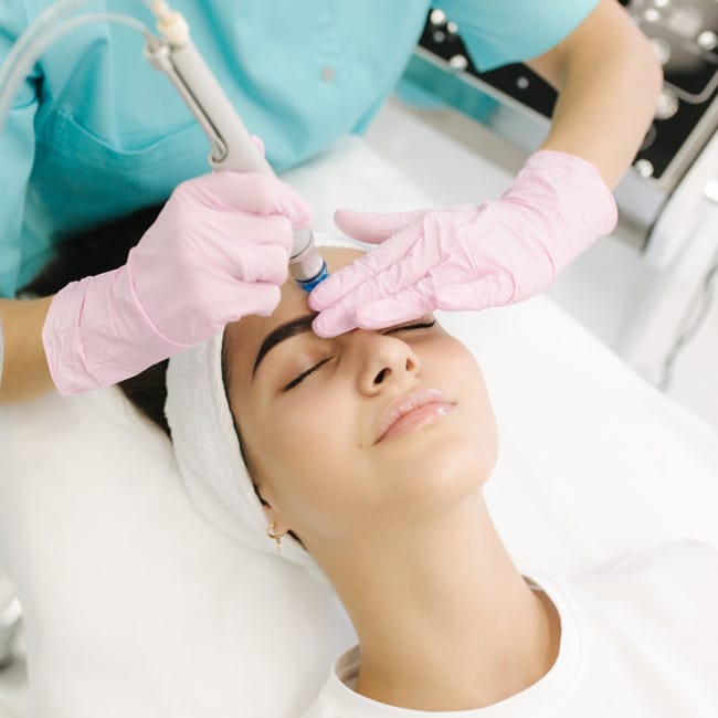 Microdermabrasion-treatment